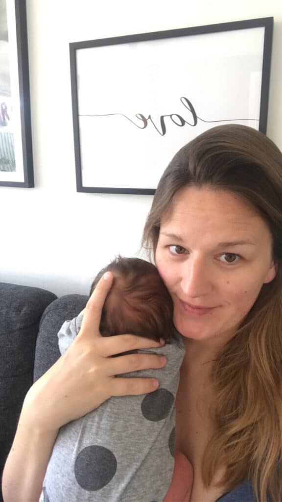 Mit Kejsersnit · Hjælp til behandling af arvæv og optræning efter kejsersnit